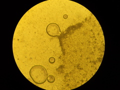 Sistotrema sernanderi