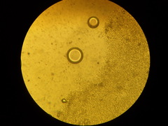 Sistotrema sernanderi