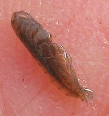 Crangonyx