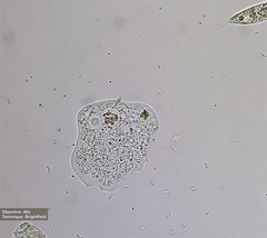 Amoebidae
