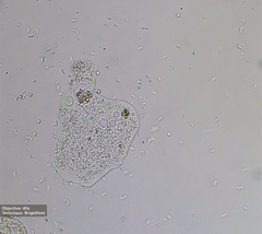 Amoebidae