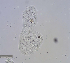 Amoebidae