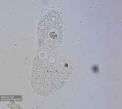 Amoebidae