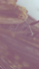 Dolophilodes distinctus