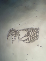 Telaranea tetrapila tetrapila