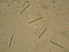 Tolypocladium longisegmentatum