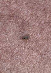 Dioxyna picciola