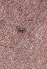 Dioxyna picciola