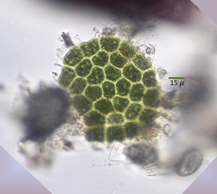 Pseudopediastrum boryanum longicorne