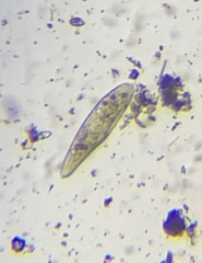 Paramecium