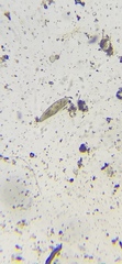 Paramecium