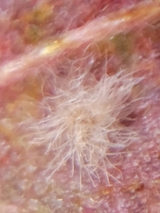 Neuroterus floccosus