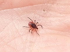 Ixodes ricinus