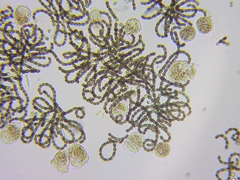 Dolichospermum lemmermannii