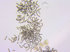 Dolichospermum lemmermannii