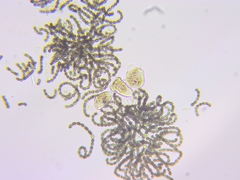 Dolichospermum lemmermannii