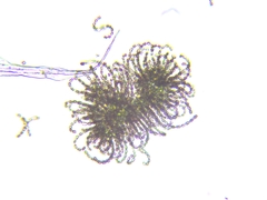 Dolichospermum lemmermannii