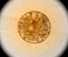 Heliozoa