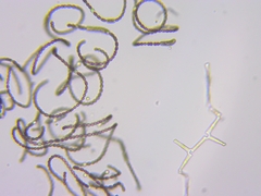 Dolichospermum flosaquae