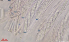 Ascocoryne cylichnium