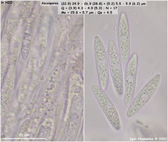 Ascocoryne cylichnium