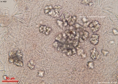 Ascocoryne cylichnium