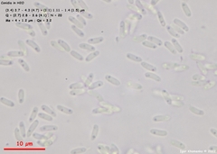 Ascocoryne cylichnium