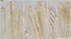 Phaeohelotium carneum