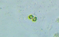 Sarcodon stereosarcinon