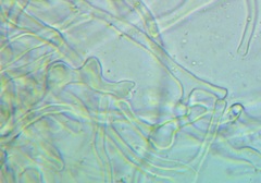 Sarcodon stereosarcinon