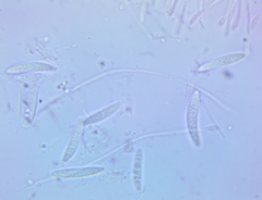 Ascocoryne cylichnium