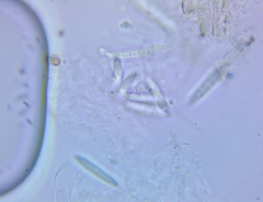 Ascocoryne cylichnium