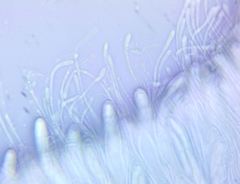 Ascocoryne cylichnium