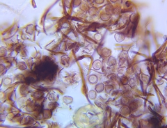 Myxomycetes