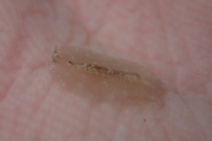 Pseudoceros canadensis