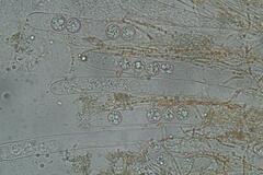 Pulvinula tetraspora