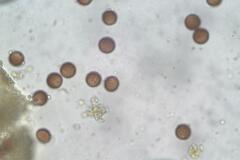 Diderma subasteroides