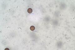 Diderma subasteroides