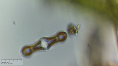 Achnanthes inflata