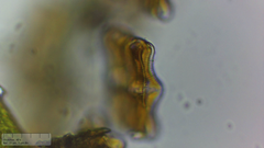 Achnanthes inflata
