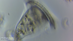 Sessilida