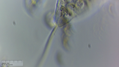 Sessilida