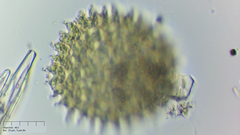 Pseudopediastrum boryanum