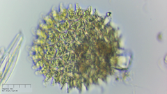 Pseudopediastrum boryanum