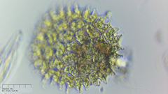 Pseudopediastrum boryanum