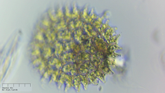 Pseudopediastrum boryanum