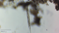 Spirostomum
