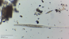 Spirostomum