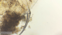 Simocephalus exspinosus