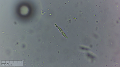 Incrucipulum ciliare